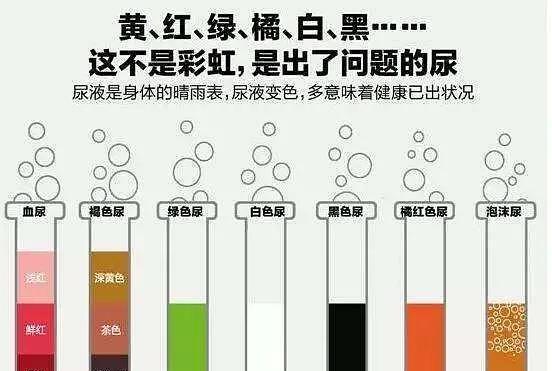 尿液变绿原因及健康含义解析