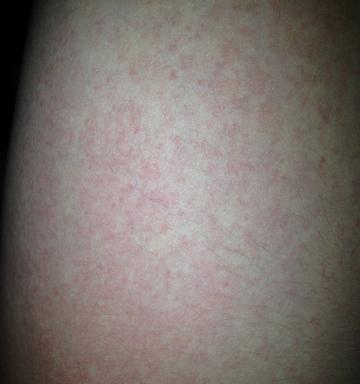 4天不吃不喝的危害：健康风险全解析