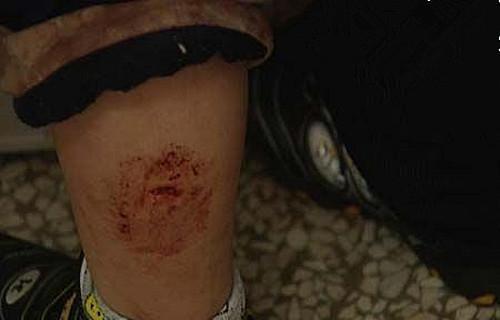 老血狗的含义解析（探寻老血狗的意义及背后的文化内涵）