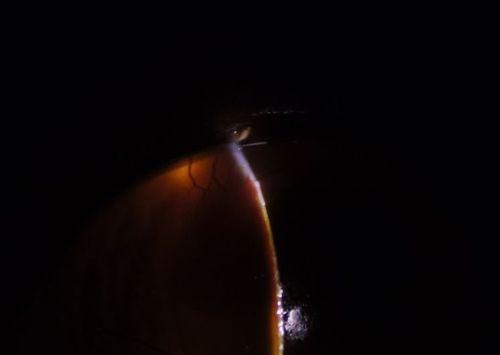 猫眼中神秘黑色物质的组成功能与保养意义解析