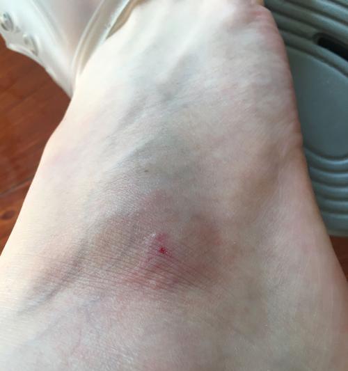 泰迪犬接种狂犬疫苗后多久能洗澡注意事项全解