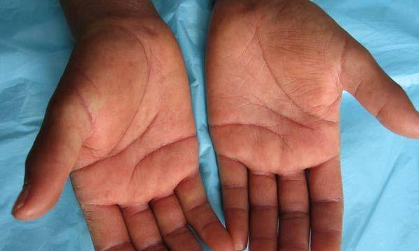 英斗皮肤病全解析：成因、类型与治疗方法指南